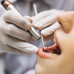 Endodoncia (Tratamiento de conducto)