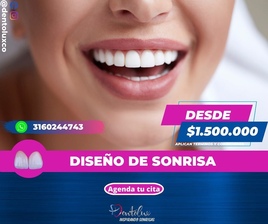 Diseño de sonrisa