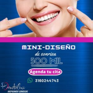 Mini diseño de sonrisa