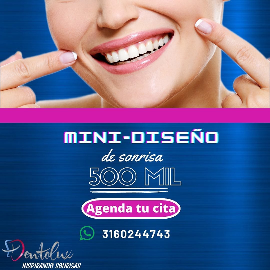 Mini diseño de sonrisa