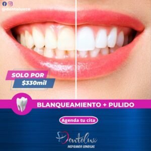 Blanqueamiento
